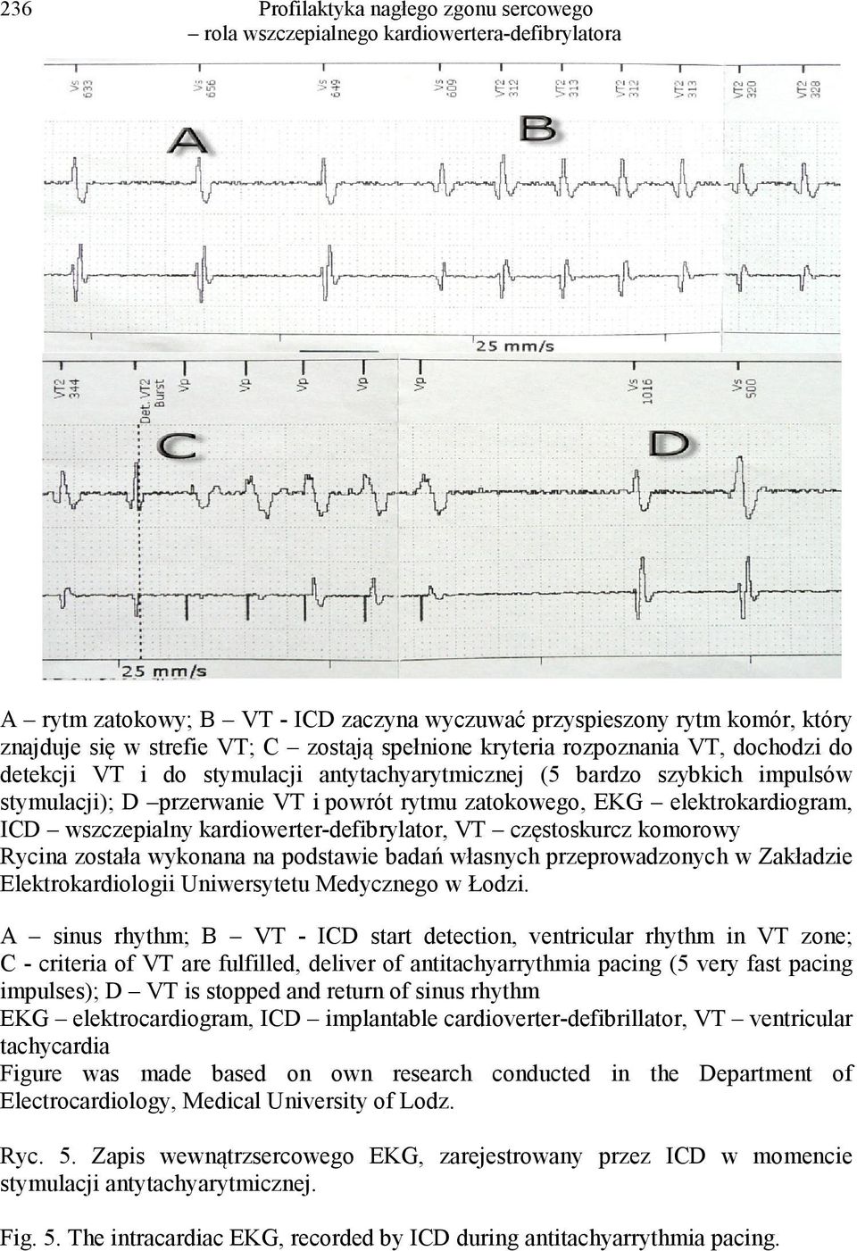 Rycina została wykonana na podstawie badań własnych przeprowadzonych w Zakładzie Elektrokardiologii Uniwersytetu Medycznego w Łodzi.