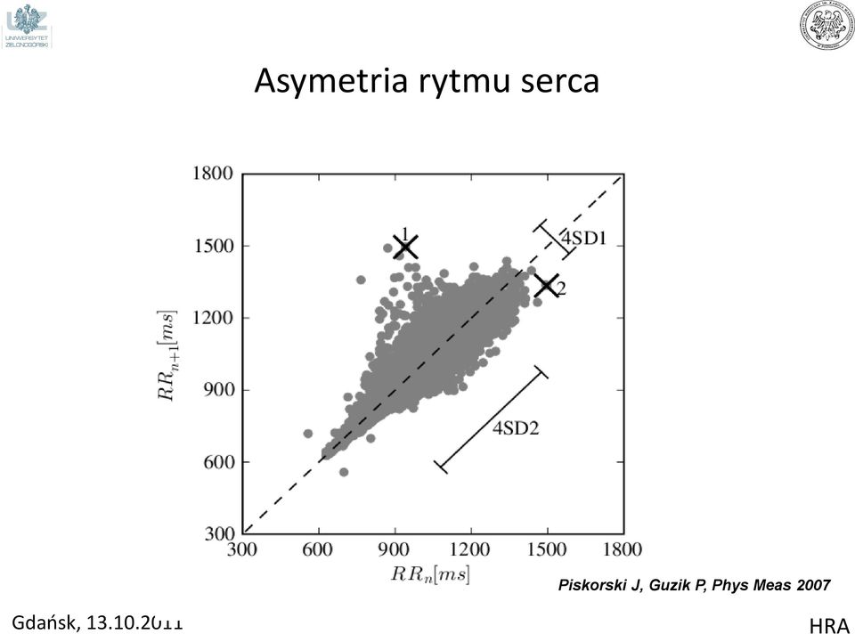 Canada Asymetria rytmu serca