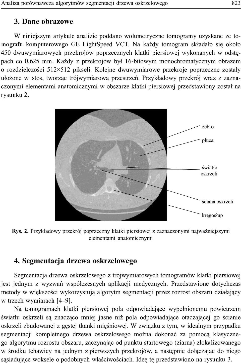 Na ka dy tomogram sk³ada³o siê oko³o 450 dwuwymiarowych przekrojów poprzecznych klatki piersiowej wykonanych w odstêpach co 0,625 mm.