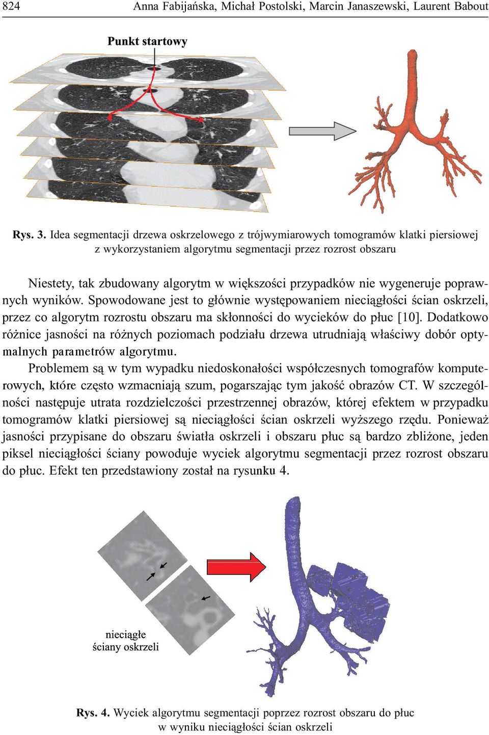 przypadków nie wygeneruje poprawnych wyników. Spowodowane jest to g³ównie wystêpowaniem nieci¹g³oœci œcian oskrzeli, przez co algorytm rozrostu obszaru ma sk³onnoœci do wycieków do p³uc [10].