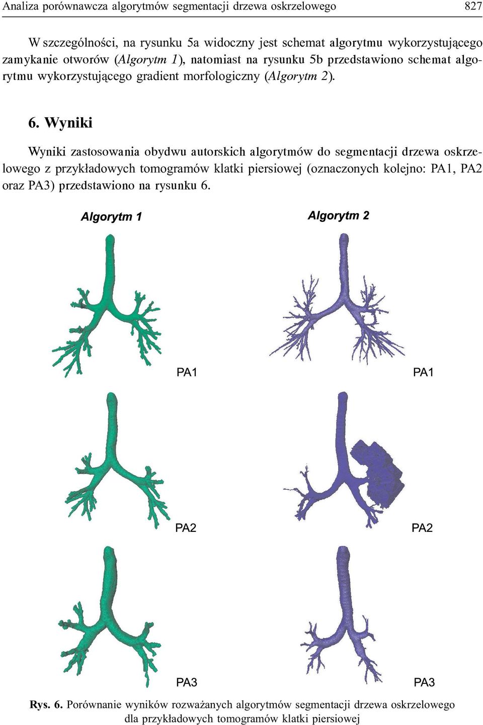 Wyniki Wyniki zastosowania obydwu autorskich algorytmów do segmentacji drzewa oskrzelowego z przyk³adowych tomogramów klatki piersiowej (oznaczonych