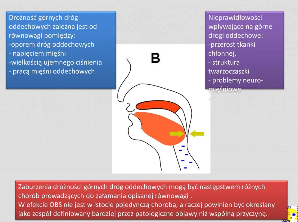 neuromięśniowe - Zaburzenia drożności górnych dróg oddechowych mogą być następstwem różnych chorób prowadzących do załamania opisanej równowagi.