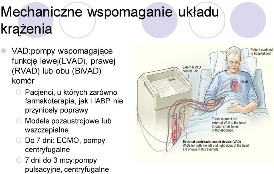 farmakoterapia, jak i IABP nie przyniosły poprawy Modele pozaustrojowe lub