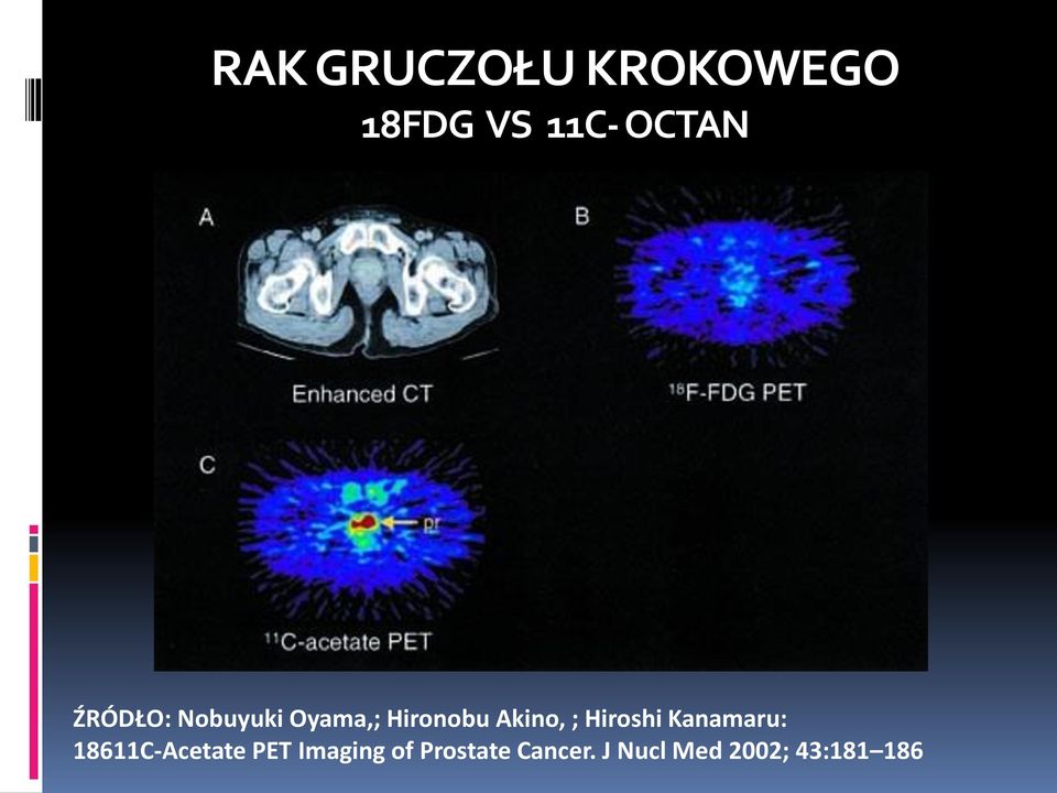 Hiroshi Kanamaru: 18611C-Acetate PET Imaging