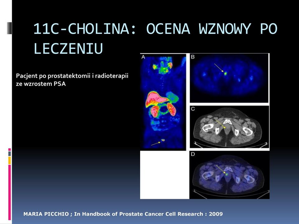 ze wzrostem PSA MARIA PICCHIO ; In