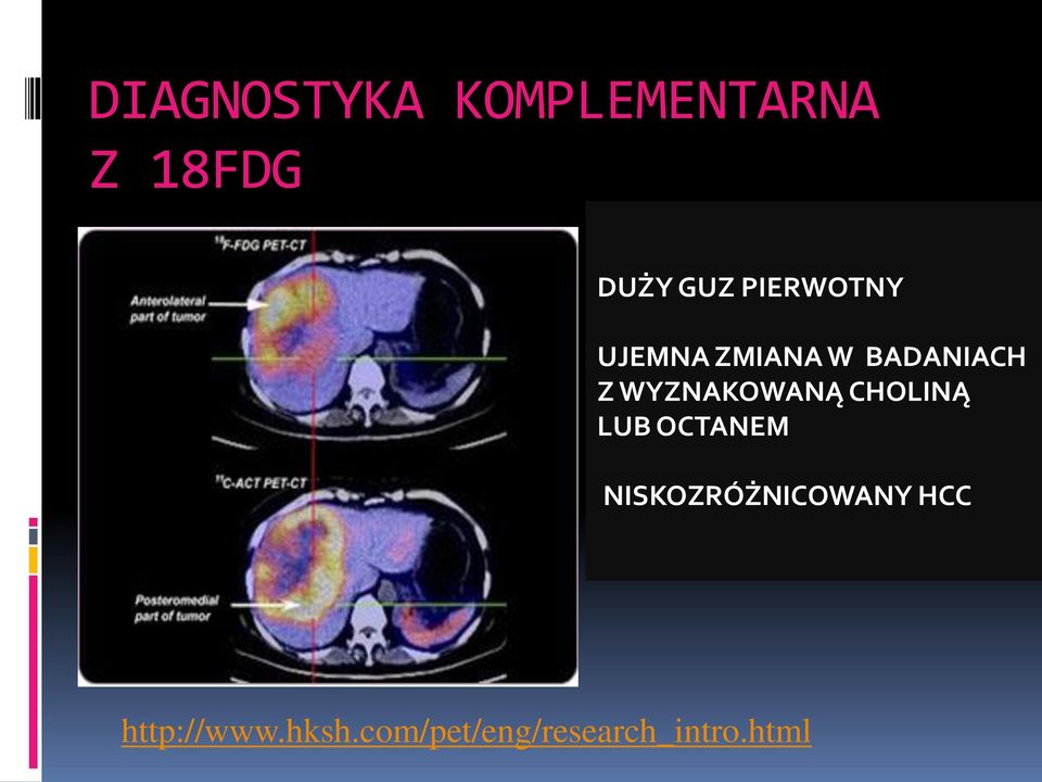 WYZNAKOWANĄ CHOLINĄ LUB OCTANEM
