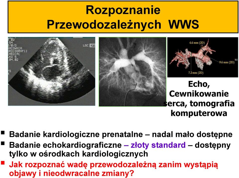 echokardiograficzne złoty standard dostępny tylko w ośrodkach