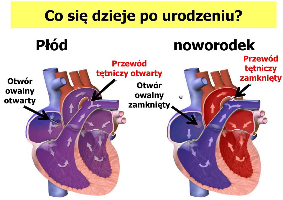 tętniczy otwarty Otwór owalny