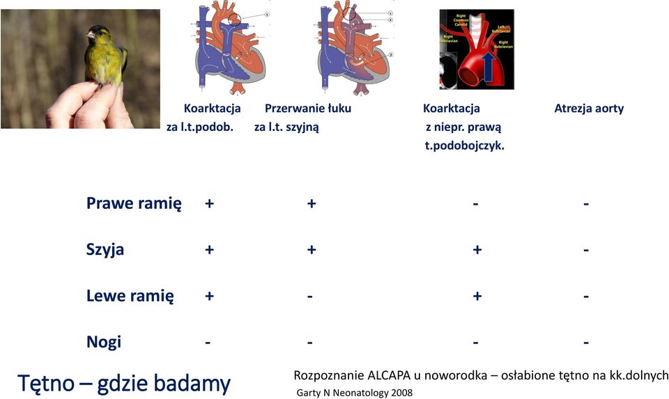 Prawe ramię + + - - Szyja + + + - Lewe ramię + - + - Nogi - - - -