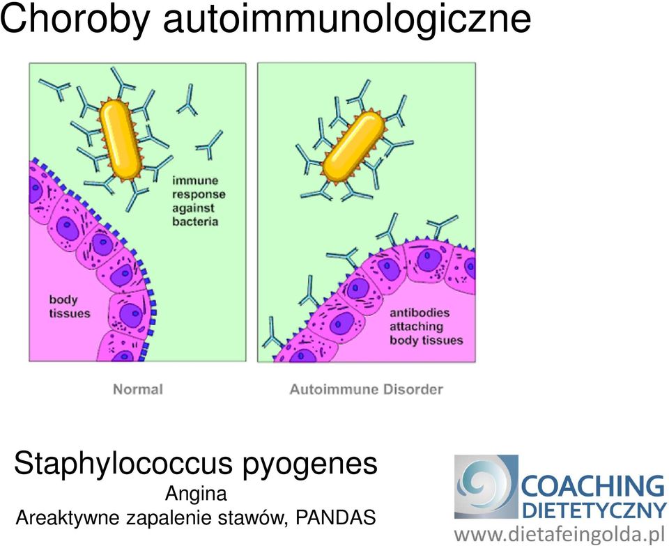 Staphylococcus pyogenes