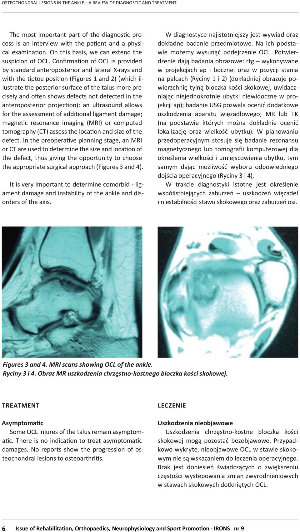 often shows defects not detected in the anteroposterior projection); an ultrasound allows for the assessment of additional ligament damage; magnetic resonance imaging (MRI) or computed tomography