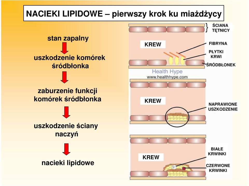 zaburzenie funkcji komórek śródbłonka KREW NAPRAWIONE USZKODZENIE