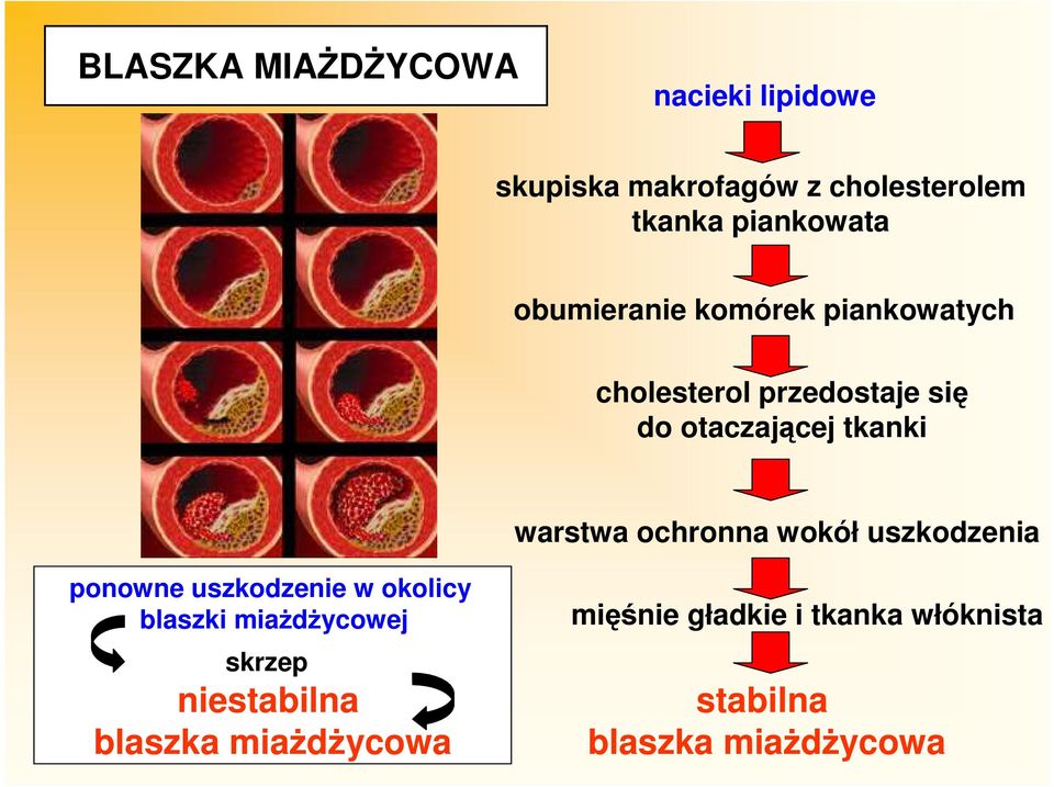 ochronna wokół uszkodzenia ponowne uszkodzenie w okolicy blaszki miażdżycowej skrzep