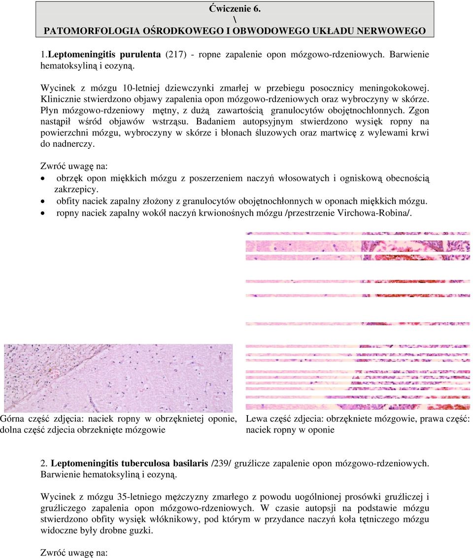 Płyn mózgowo-rdzeniowy mętny, z dużą zawartością granulocytów obojętnochłonnych. Zgon nastąpił wśród objawów wstrząsu.