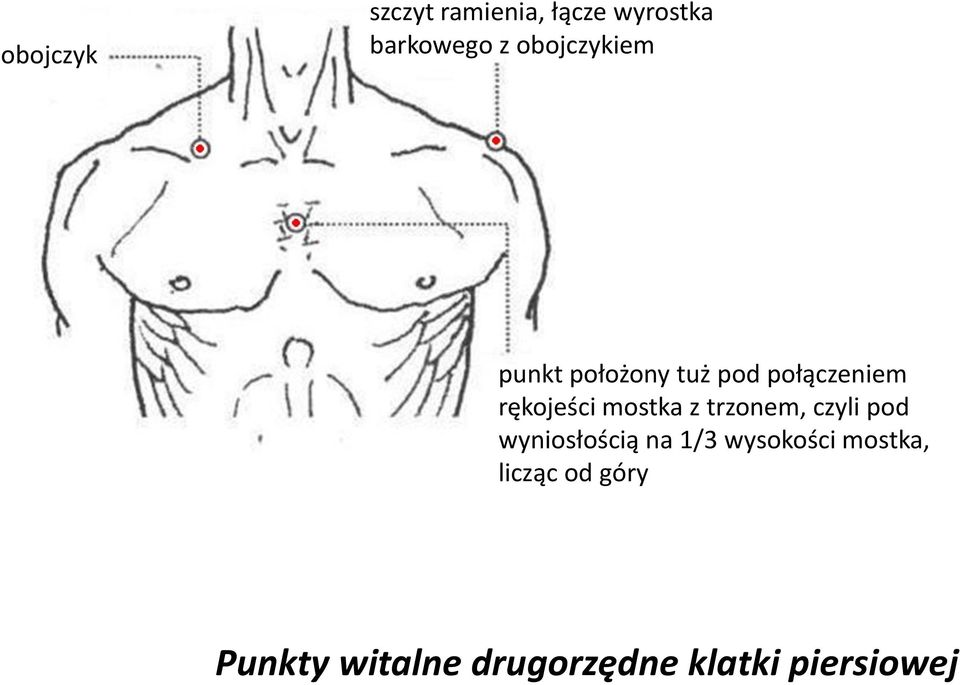 mostka z trzonem, czyli pod wyniosłością na 1/3 wysokości