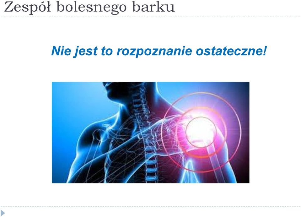 barku Nie jest