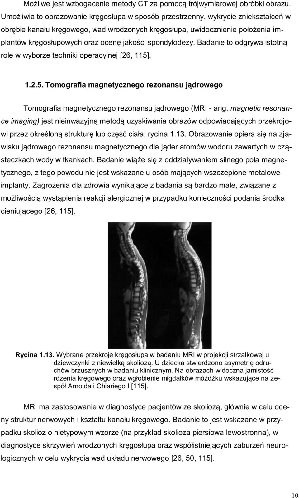 jakości spondylodezy. Badanie to odgrywa istotną rolę w wyborze techniki operacyjnej [26, 115]. 1.2.5. Tomografia magnetycznego rezonansu jądrowego Tomografia magnetycznego rezonansu jądrowego (MRI - ang.