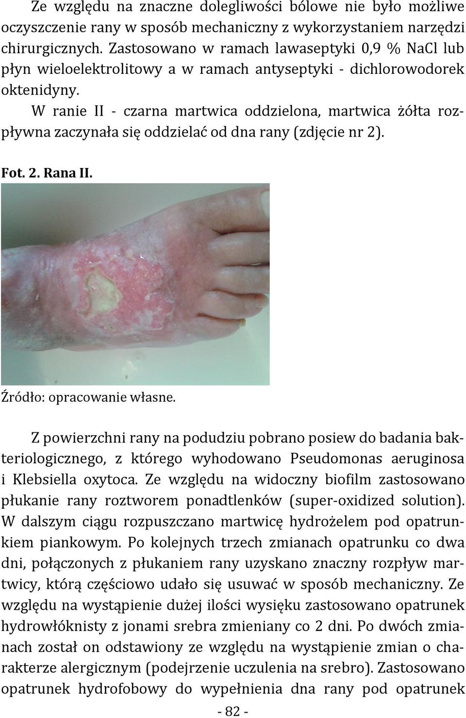 W ranie II - czarna martwica oddzielona, martwica żółta rozpływna zaczynała się oddzielać od dna rany (zdjęcie nr 2). Fot. 2. Rana II. Źródło: opracowanie własne.