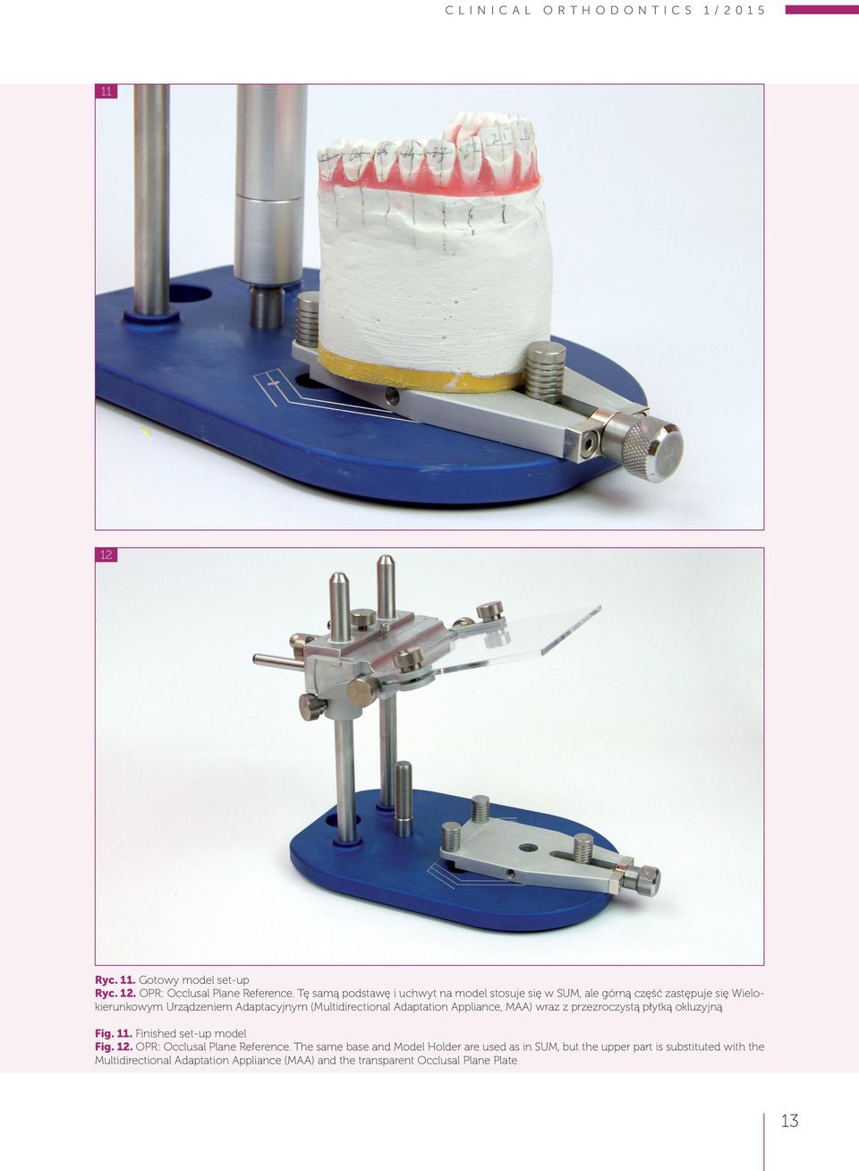 (Multidirectional Adaptation Appliance, MAA) wraz z przezroczystą płytką okluzyjną Fig. 11. Finished set-up model Fig. 12.