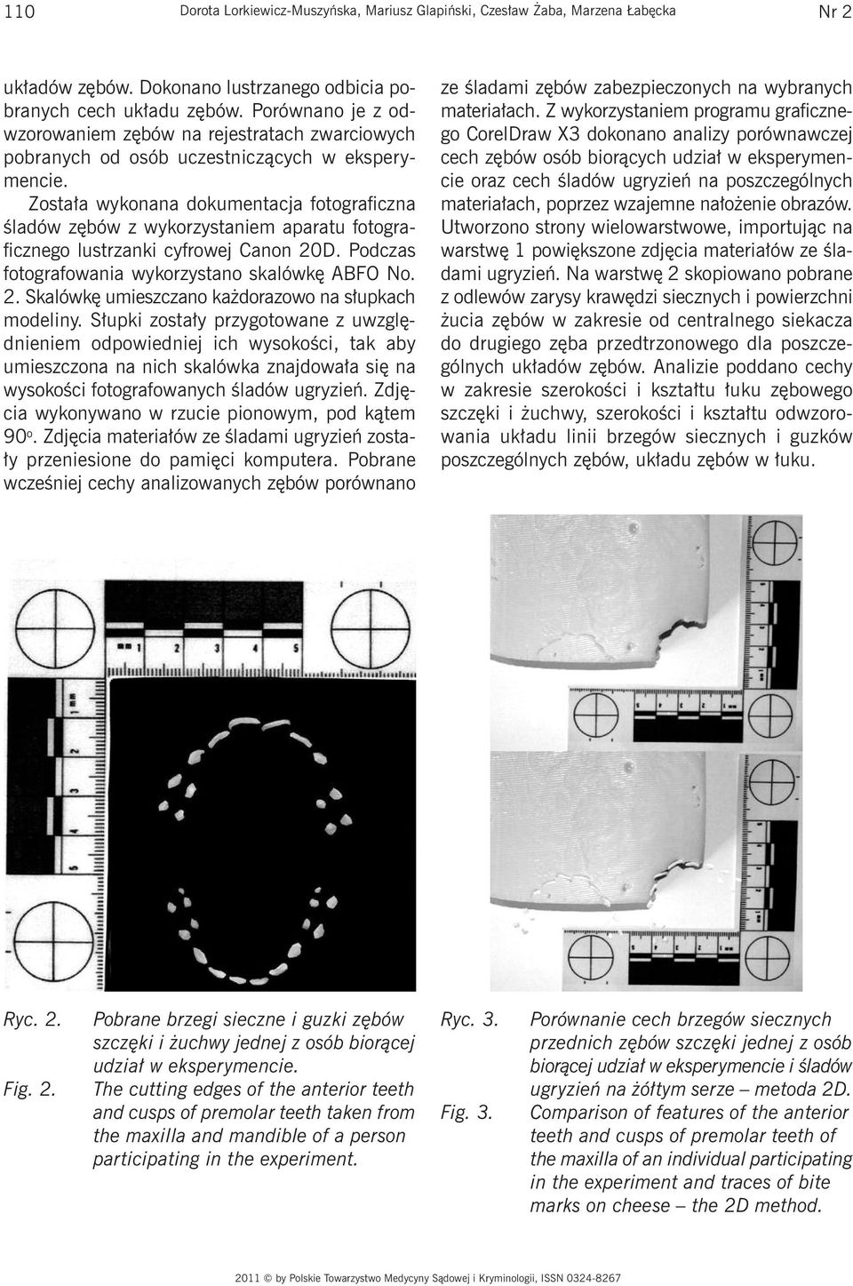 Została wykonana dokumentacja fotograficzna śladów zębów z wykorzystaniem aparatu fotograficznego lustrzanki cyfrowej Canon 20D. Podczas fotografowania wykorzystano skalówkę ABFO No. 2. Skalówkę umieszczano każdorazowo na słupkach modeliny.