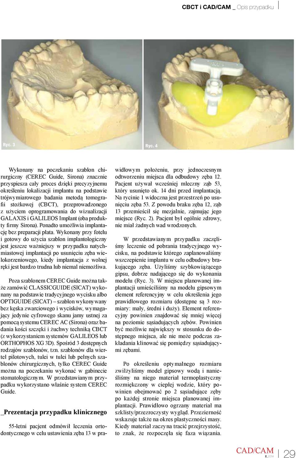 tomograii stożkowej (CBCT), przeprowadzonego z użyciem oprogramowania do wizualizacji GALAXIS i GALILEOS Implant (oba produkty irmy Sirona). Ponadto umożliwia implantację bez preparacji płata.