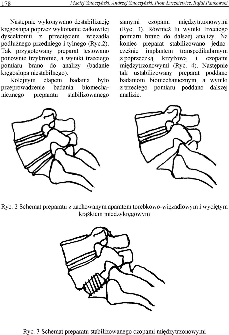 Kolejnym etapem badania było przeprowadzenie badania biomechanicznego preparatu stabilizowanego samymi czopami międzytrzonowymi (Ryc. 3). Również tu wyniki trzeciego pomiaru brano do dalszej analizy.