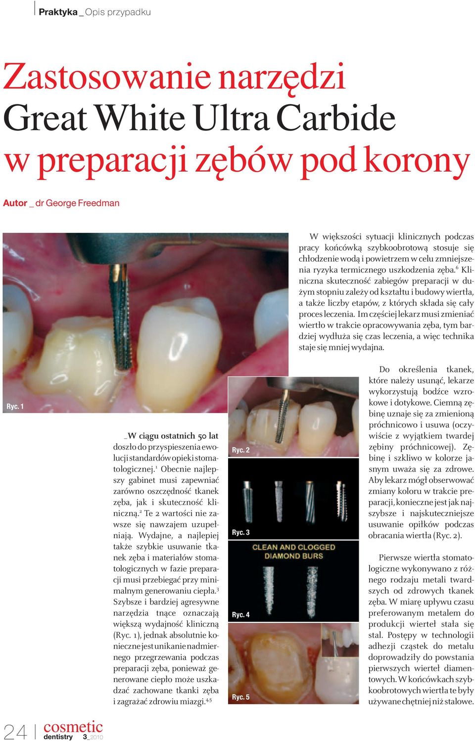 6 Kliniczna skuteczność zabiegów preparacji w dużym stopniu zależy od kształtu i budowy wiertła, a także liczby etapów, z których składa się cały proces leczenia.