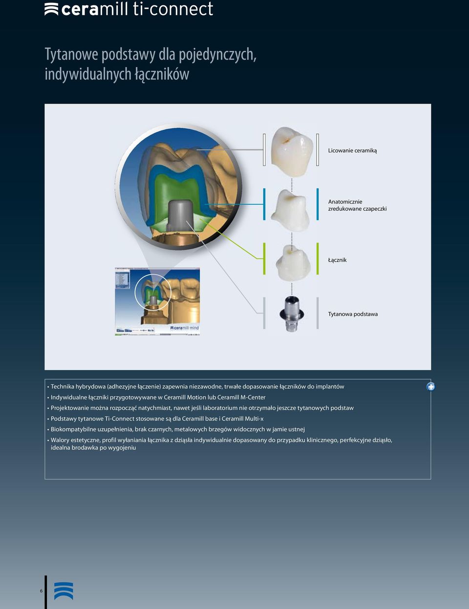 laboratorium nie otrzymało jeszcze tytanowych podstaw Podstawy tytanowe Ti-Connect stosowane są dla Ceramill base i Ceramill Multi-x Biokompatybilne uzupełnienia, brak czarnych, metalowych