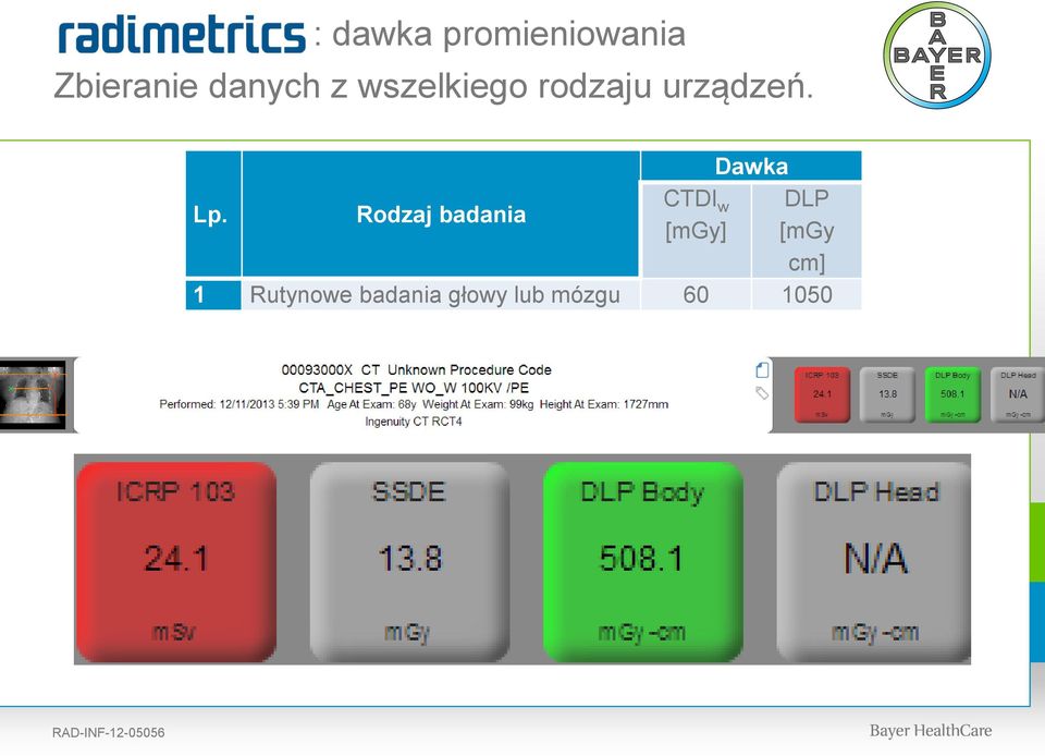 Rodzaj badania Dawka cm] CTDI w DLP