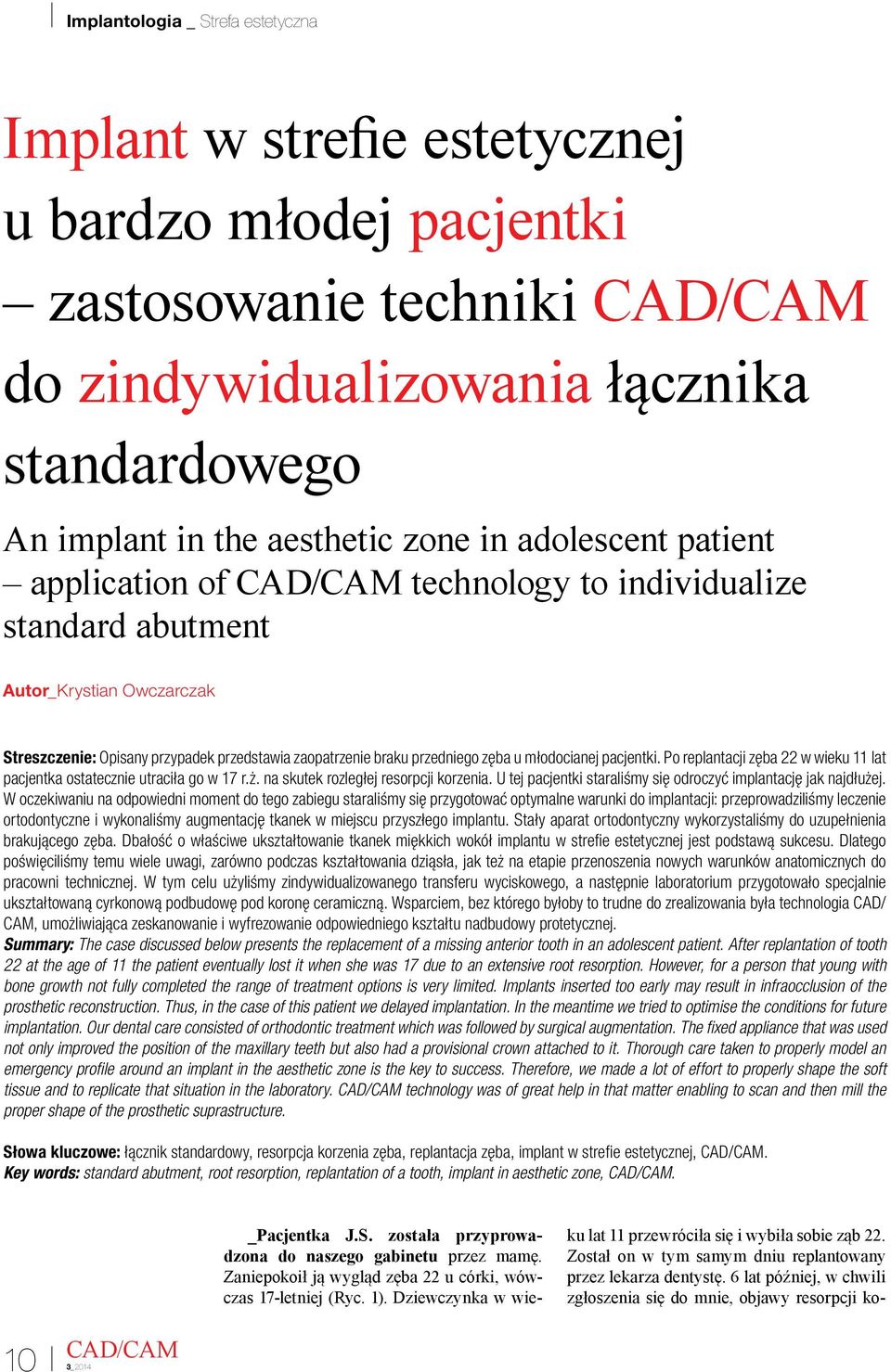 Po replantacji zęba 22 w wieku 11 lat pacjentka ostatecznie utraciła go w 17 r.ż. na skutek rozległej resorpcji korzenia. U tej pacjentki staraliśmy się odroczyć implantację jak najdłużej.
