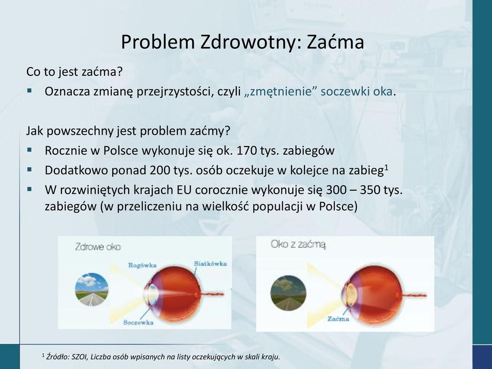 osób oczekuje w kolejce na zabieg 1 W rozwiniętych krajach EU corocznie wykonuje się 300 350 tys.