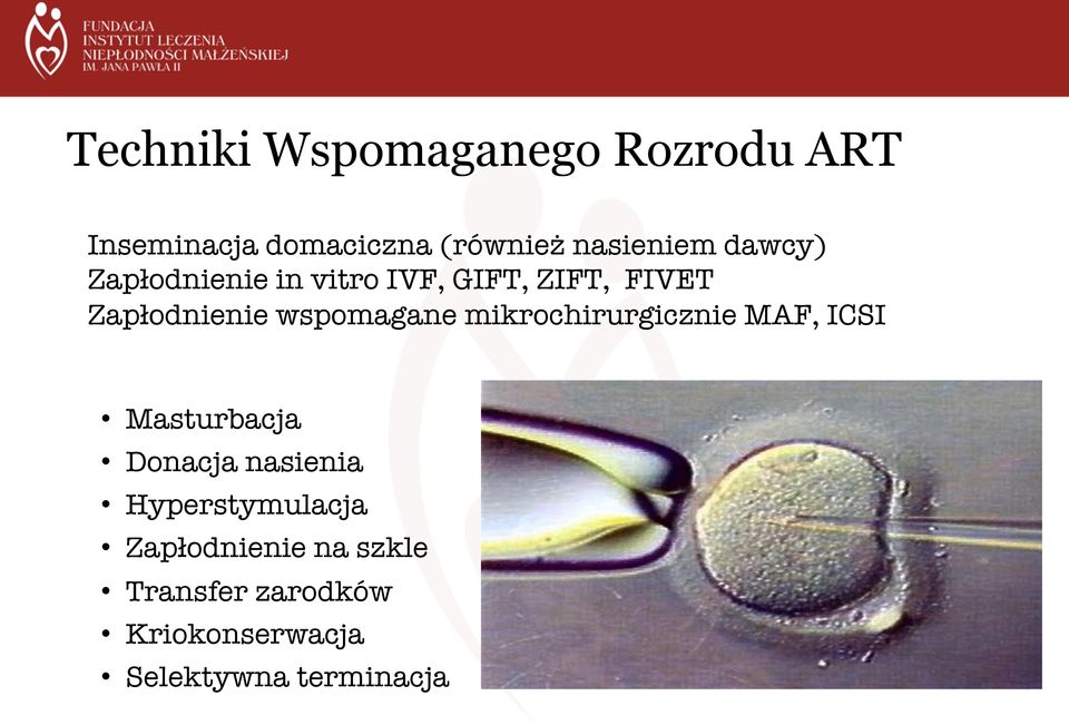 wspomagane mikrochirurgicznie MAF, ICSI " Masturbacja Donacja nasienia