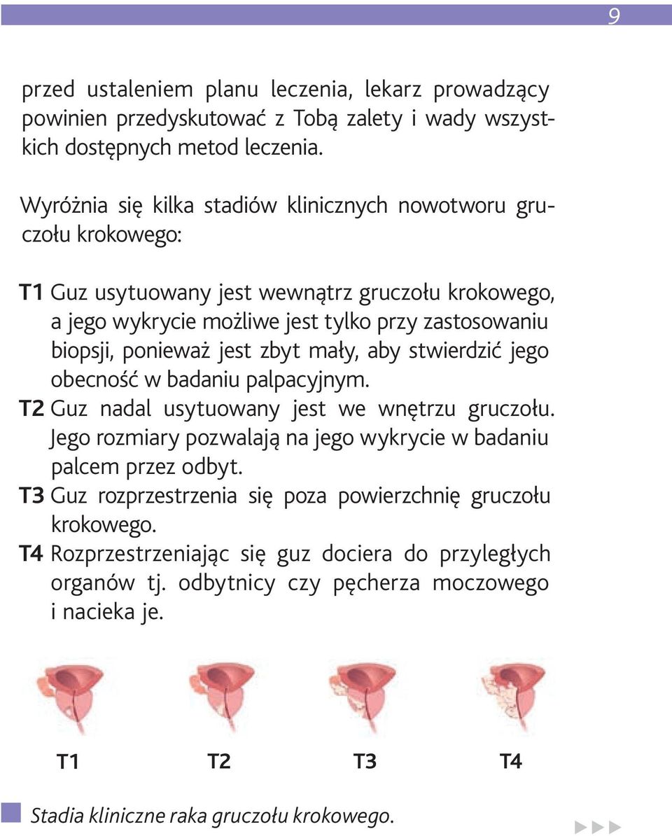 ponieważ jest zbyt mały, aby stwierdzić jego obecność w badaniu palpacyjnym. T2 Guz nadal usytuowany jest we wnętrzu gruczołu.