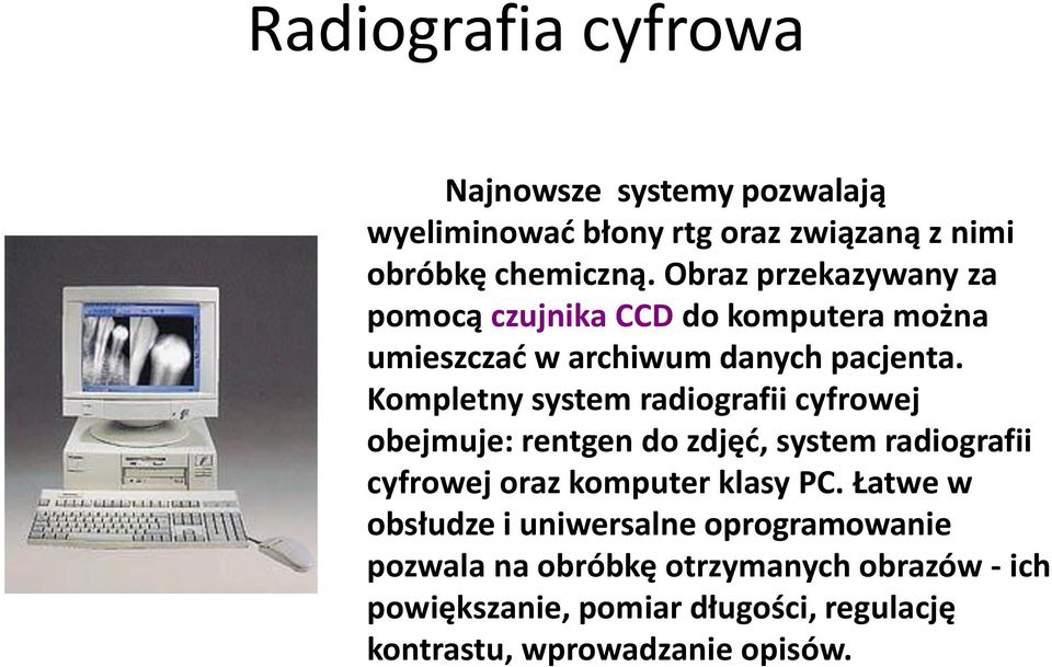 Kompletny system radiografii cyfrowej obejmuje: rentgen do zdjęć, system radiografii cyfrowej oraz komputer klasy PC.