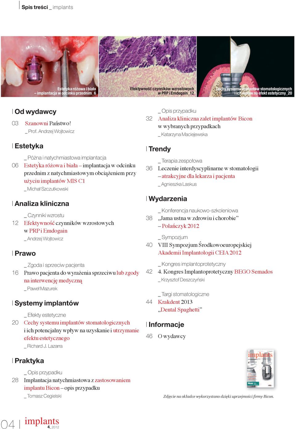 Andrzej Wojtowicz I Estetyka _ Pó na i natychmiastowa implantacja 06 Estetyka różowa i biała implantacja w odcinku przednim z natychmiastowym obciążeniem przy użyciu implantów MIS C1 _ Micha