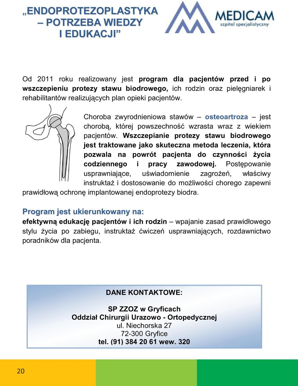 Wszczepinie protezy stwu biodrowego jest trktowne jko skuteczn metod leczeni, któr codziennego i prcy zwodowej. y biodr.