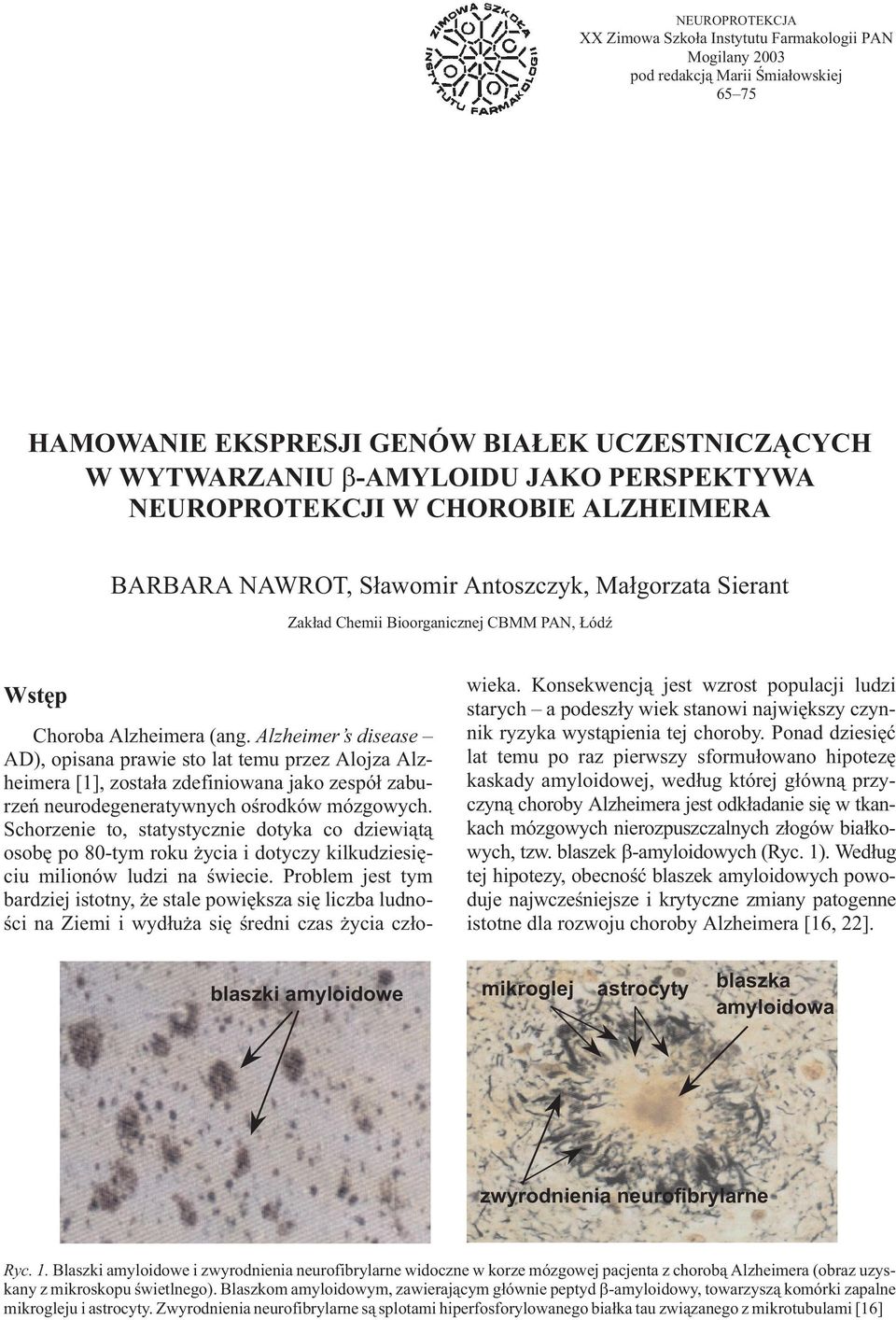 Alzheimer s disease AD), opisana prawie sto lat temu przez Alojza Alzheimera [1], zosta³a zdefiniowana jako zespó³ zaburzeñ neurodegeneratywnych oœrodków mózgowych.