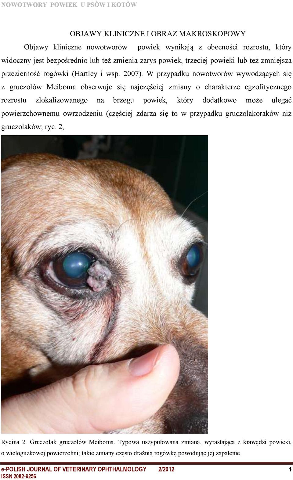 W przypadku nowotworów wywodzących się z gruczołów Meiboma obserwuje się najczęściej zmiany o charakterze egzofitycznego rozrostu zlokalizowanego na brzegu powiek, który dodatkowo może ulegać