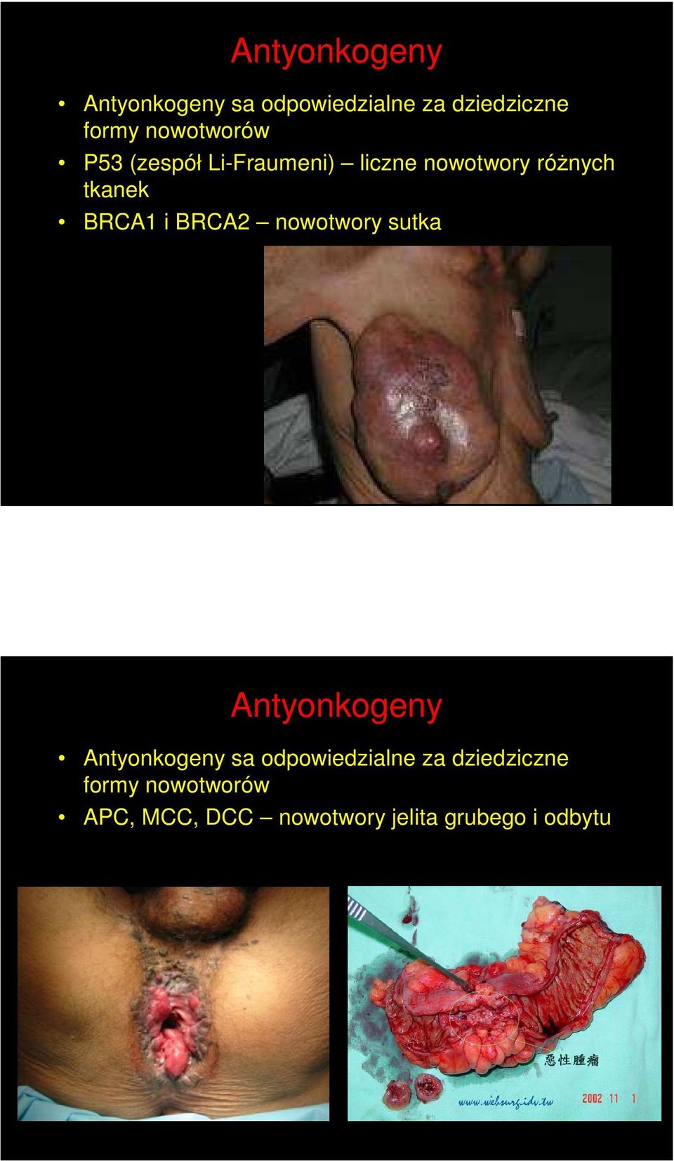BRCA1 i BRCA2 nowotwory sutka  nowotworów APC, MCC, DCC nowotwory