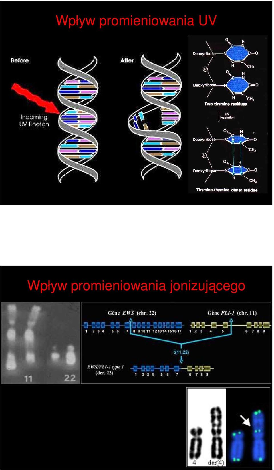 UV  