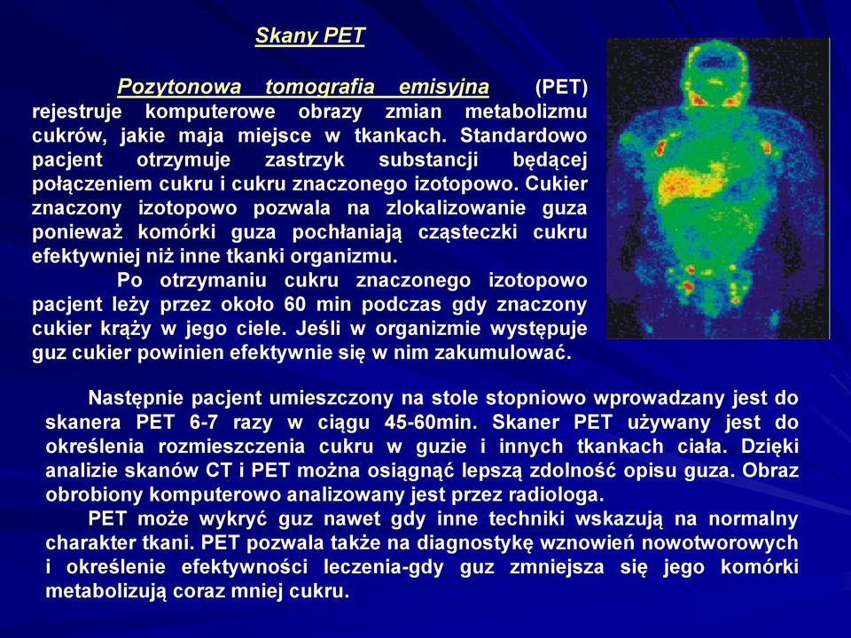 Cukier znaczony izotopowo pozwala na zlokalizowanie guza ponieważ komórki guza pochłaniają cząsteczki cukru efektywniej niż inne tkanki organizmu.