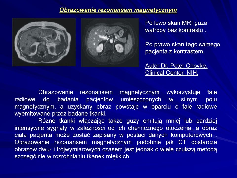 przez badane tkanki.