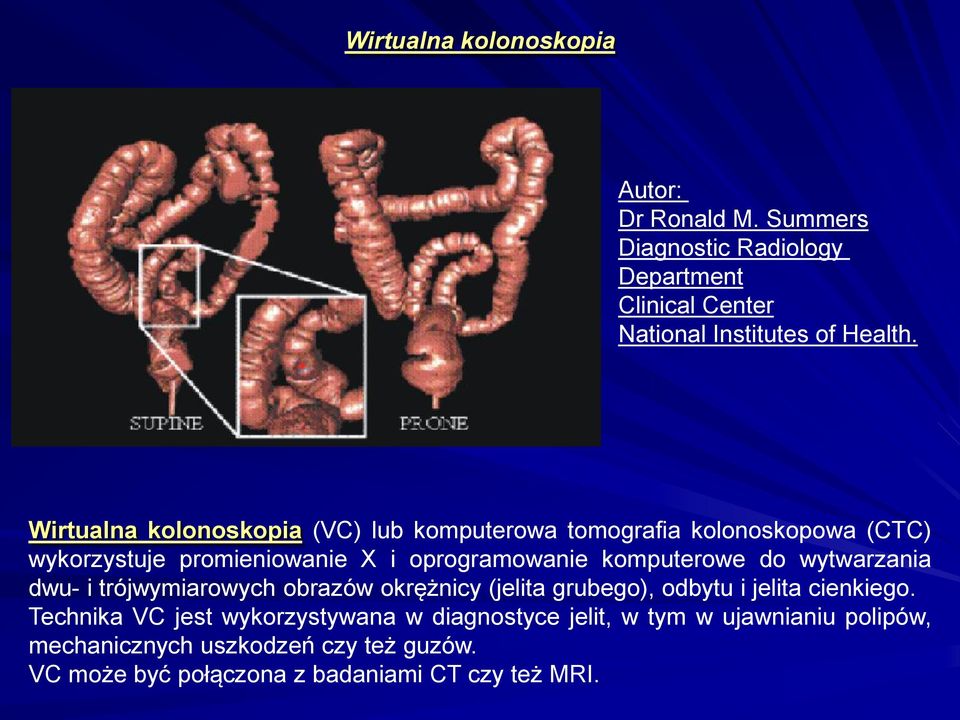 do wytwarzania dwu- i trójwymiarowych obrazów okrężnicy (jelita grubego), odbytu i jelita cienkiego.