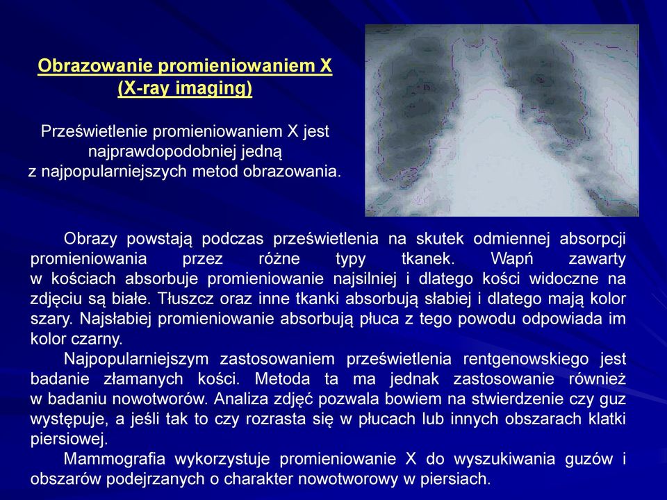 Wapń zawarty w kościach absorbuje promieniowanie najsilniej i dlatego kości widoczne na zdjęciu są białe. Tłuszcz oraz inne tkanki absorbują słabiej i dlatego mają kolor szary.