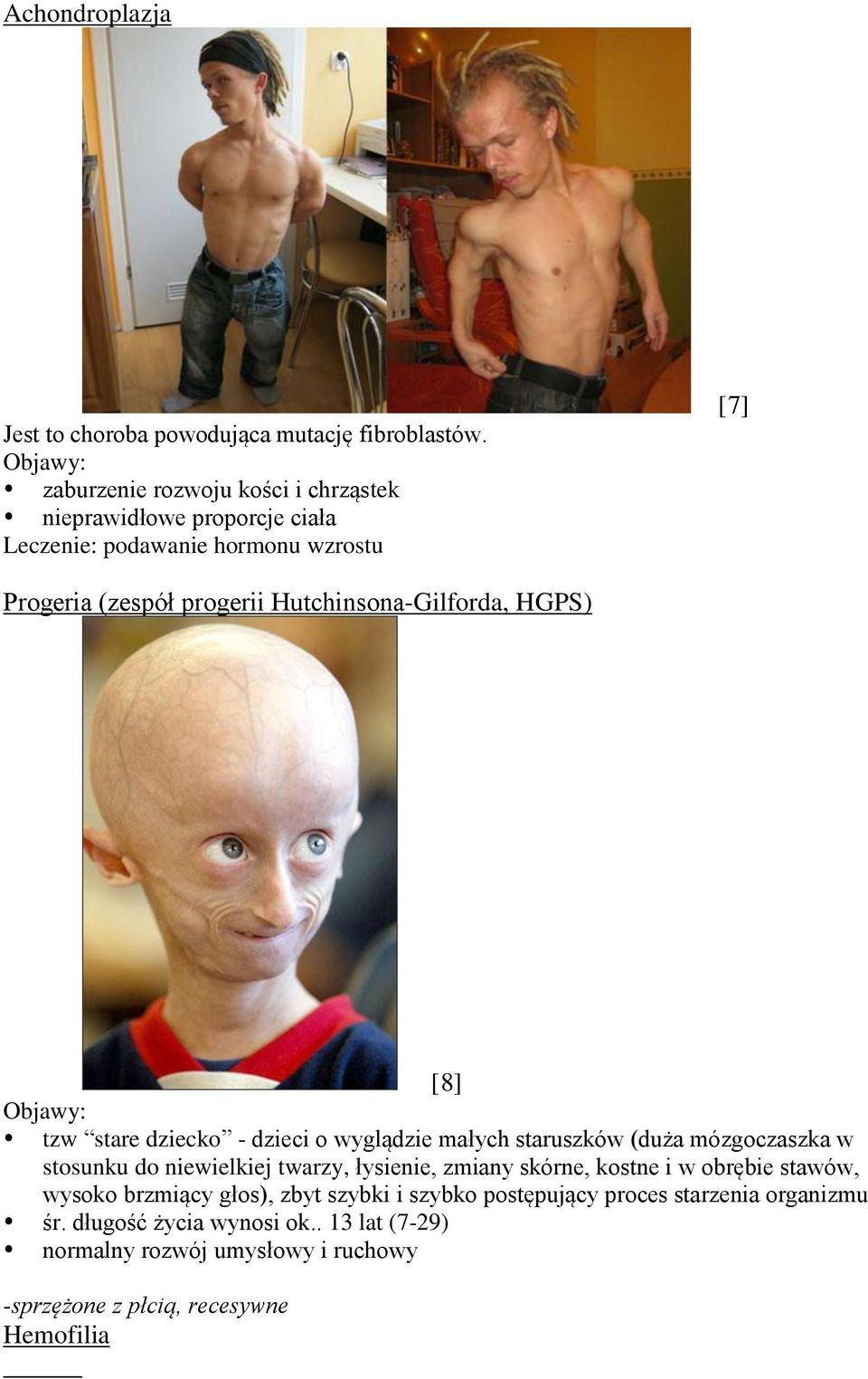 Hutchinsona-Gilforda, HGPS) [8] tzw stare dziecko - dzieci o wyglądzie małych staruszków (duża mózgoczaszka w stosunku do niewielkiej twarzy,