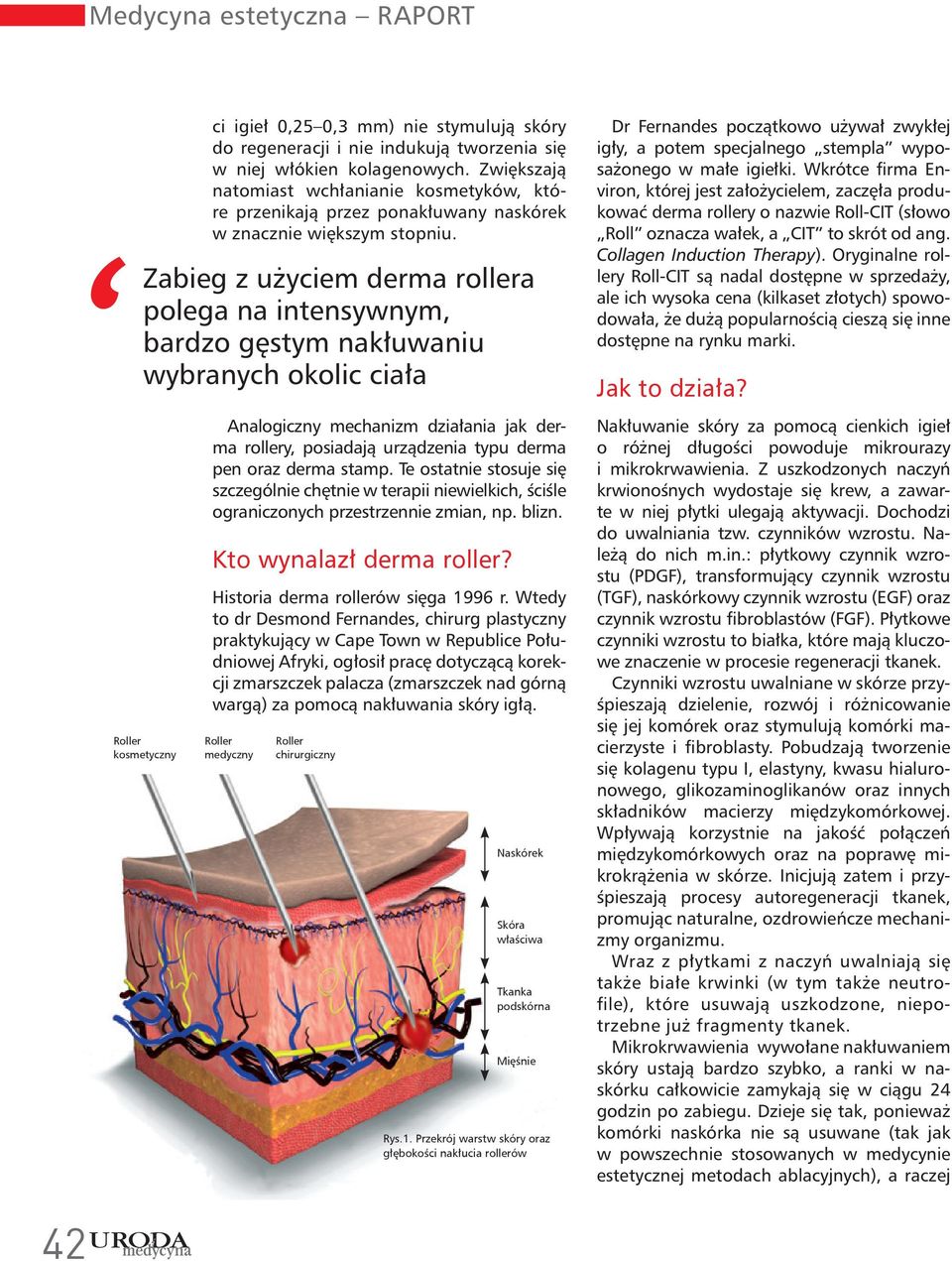 Zabieg z użyciem derma rollera polega na intensywnym, bardzo gęstym nakłuwaniu wybranych okolic ciała Roller kosmetyczny Analogiczny mechanizm działania jak derma rollery, posiadają urządzenia typu
