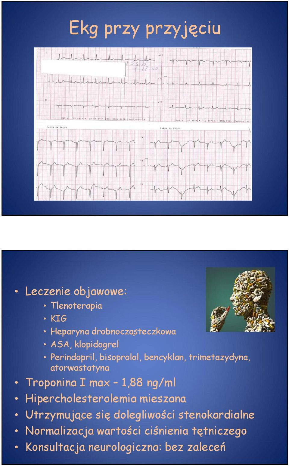 I max 1,88 ng/ml Hipercholesterolemia mieszana Utrzymujące się dolegliwości