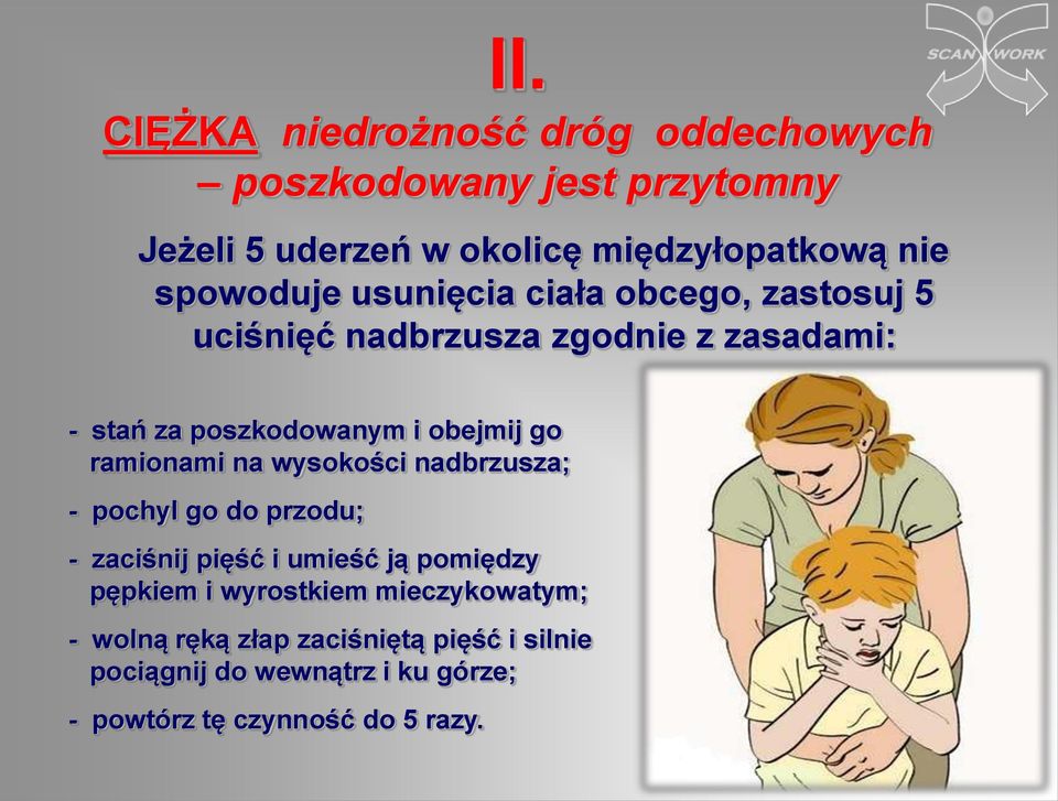 go ramionami na wysokości nadbrzusza; - pochyl go do przodu; - zaciśnij pięść i umieść ją pomiędzy pępkiem i wyrostkiem