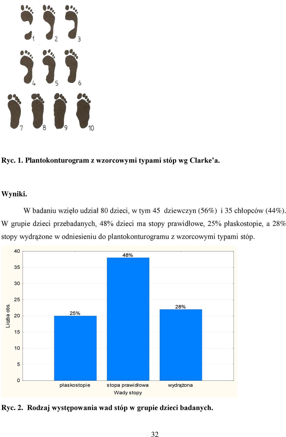 W grupie dzieci przebadanych, 48% dzieci ma stopy prawidłowe, 25% płaskostopie, a 28% stopy wydrążone w odniesieniu do