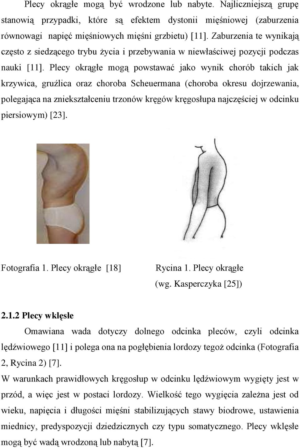 Plecy okrągłe mogą powstawać jako wynik chorób takich jak krzywica, gruźlica oraz choroba Scheuermana (choroba okresu dojrzewania, polegająca na zniekształceniu trzonów kręgów kręgosłupa najczęściej